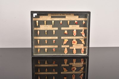Lot 188 - A Waxwork 'Diseases of the Teeth' display